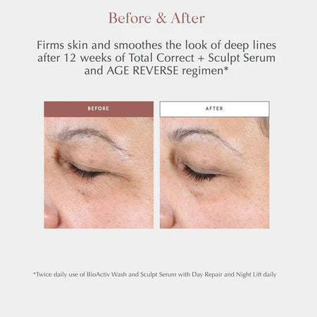 Exuviance AGE REVERSE+ Advanced Total Correct Serum 30ml